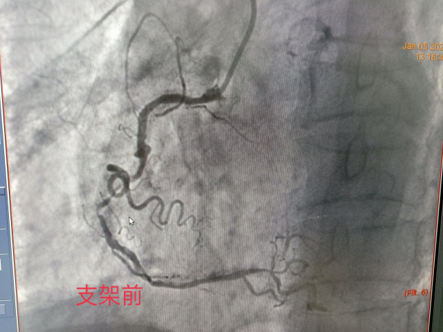 1641524742172447.jpg 微信图片_20220106152300.jpg